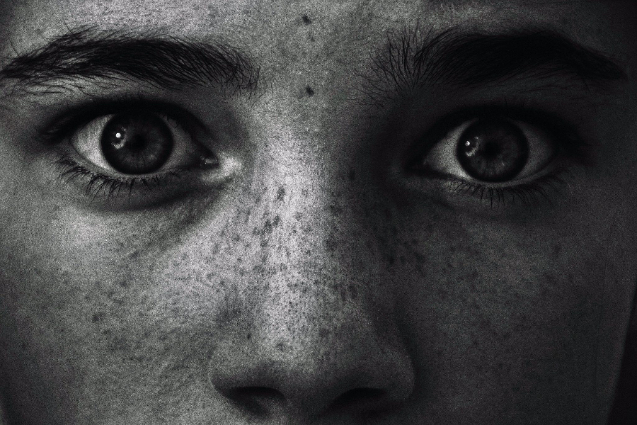 Woman with bushy eyebrows and freckles